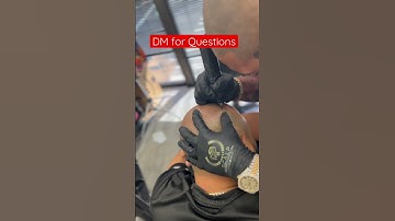 #scalpmicropigmentation #smp #smpartist #scalpmicropigmentationtraining #hairloss