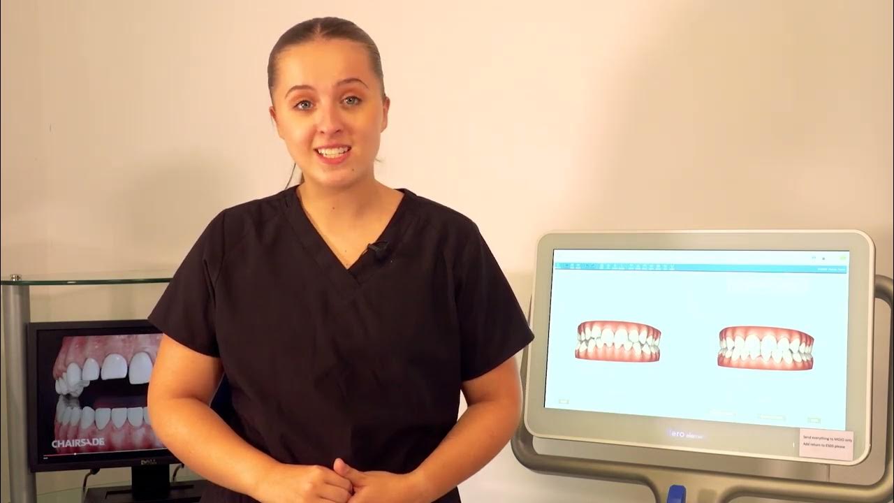 Croydon Orthodontic Practice Mild Cases YouTube