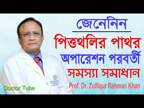 ভিডিও: রেডিয়েটরগুলিতে পিনহোলের কারণ কী?