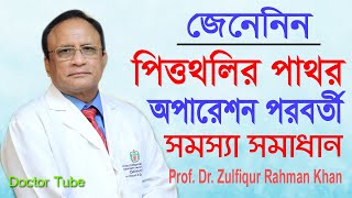 পিত্তথলির পাথর অপারেশন পরবর্তী সমস্যা সমাধান || Gallbladder Stone infection | Bangla Health Tips