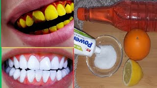 it will make yellow, dirty teeth pearly white and shiny in 2 minutes - Teeth whitening