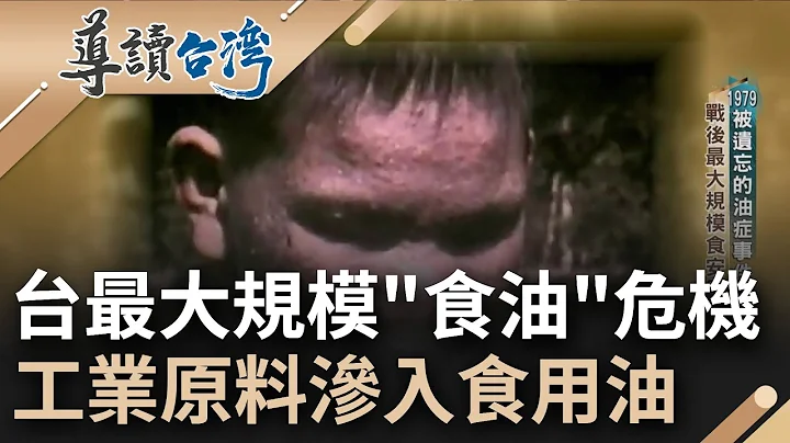 被遗忘的历史! 台湾战后大规模"食安风暴"学童被迫用健康写下历史 工业原料"多氯联苯"渗入米糠油 负责人脱产"上千油症受害人"求偿无门｜谢哲青 主持｜【导读台湾 完整版】20230219｜三立新闻台 - 天天要闻