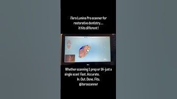 iTero Lumina™ dental scanner review