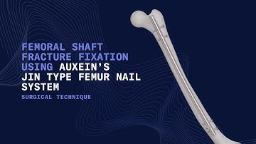 Mastering Femoral Fracture Fixation-The Jin Type Femoral Nailing System