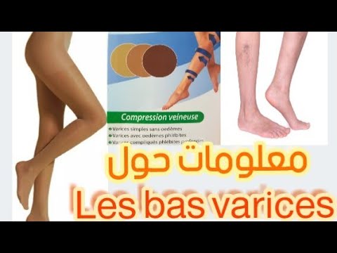 Vidéo: Bas De Compression Pour Varices: Avantages Et Utilisations