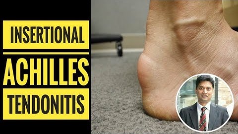 Insertional Achilles Tendinitis (How to Diagnose?)