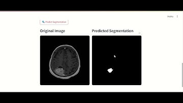 Brain tumor segmentation Using MRI Images