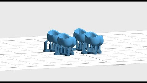 Digital Dentistry : 3D printing Temporary Crown