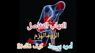 التهاب و آلام المفاصل:مشكلة بسيطة لو عرفنا الأسباب.علاج دائم وعلاجات فورية.التهاب_المفاصل