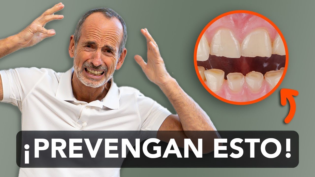 EJERCICIOS contra el RECHINAR de DIENTES durante el sueño (DOLOR DE ...
