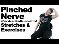 Pinched nerve cervical radiculopathy stretches  exercises  ask doctor jo