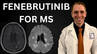 Fenebrutinib for Multiple Sclerosis Explained by Neurologist by Dr. Brandon Beaber 5,872 views 5 months ago 13 minutes, 15 seconds