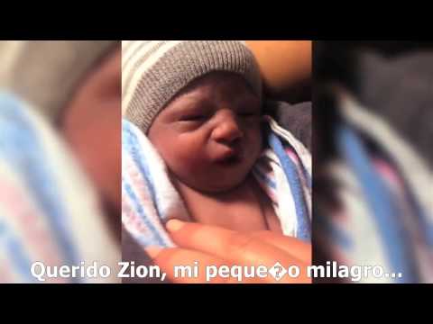 Video: ¿Cómo saber si su bebé tiene trisomía 18?