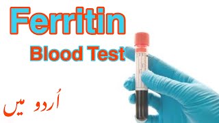 Ferritin test in urdu | level blood test: purpose, procedure, and
results