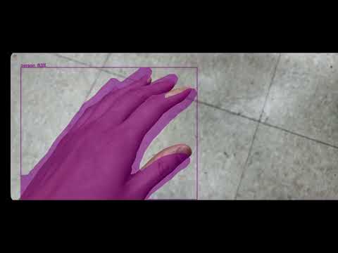 YOLOv8 segmentation with android