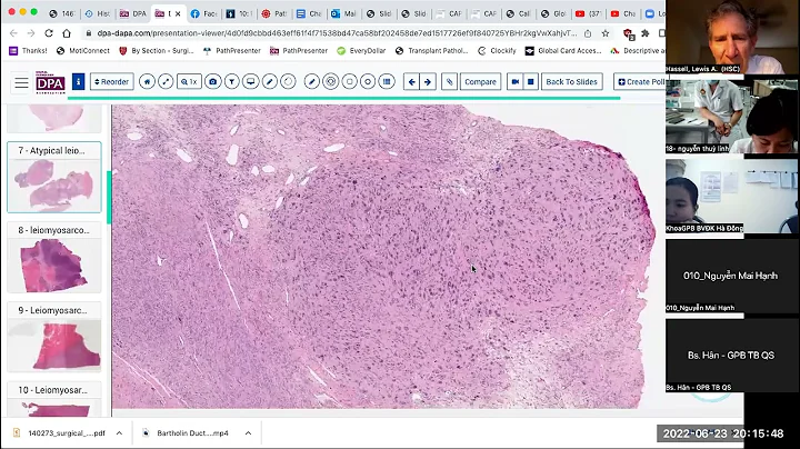 Hospital 103 Series- Smooth Muscle Tumors of Uteru...