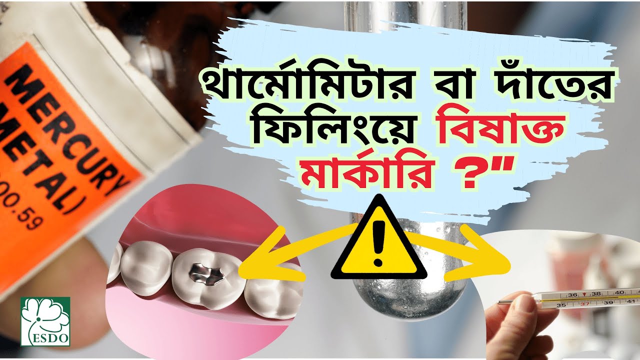 Mercury in Thermometer and Dentistry Treatment। ESDO