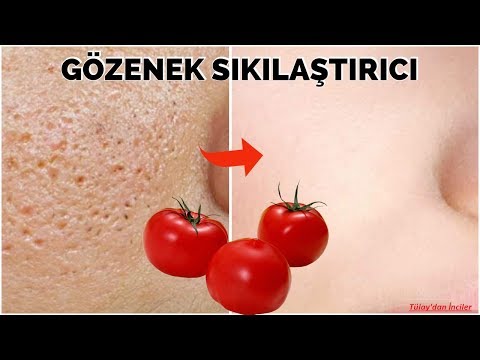 DOMATESLE GÖZENEKLERDEN KURTUL! GÖZENEK SIKILAŞTIRICI DOMATES TARİFİ - Güzellik - Bakım