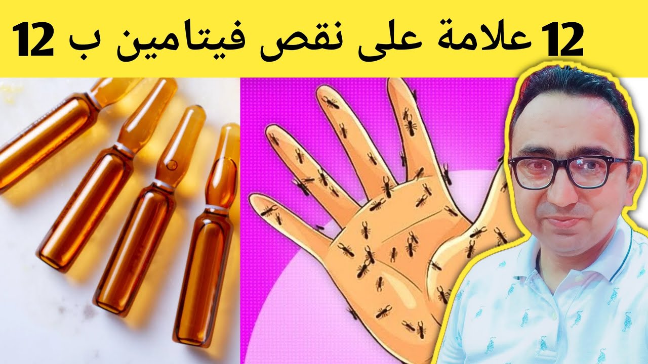 12 علامة لنقص فيتامين ب12 يجب أن تعرفها