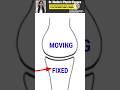 Concave-Convex Rule in Arthrokinematics 2024 📚