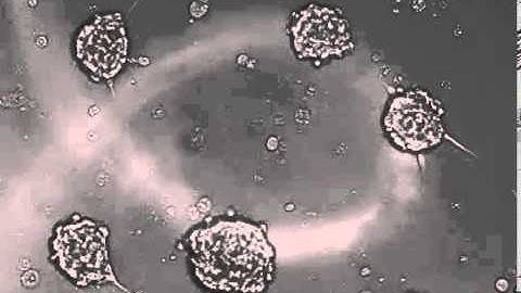 Etaluma - Human Neural Stem Cells in Culture 1