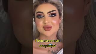 Последствия пластических операций необратимы.Есть альтернатива - массаж и фейсфитнес.Подписывайся!