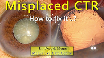 Misplaced CTR : How to fix it..? Dr Deepak Megur