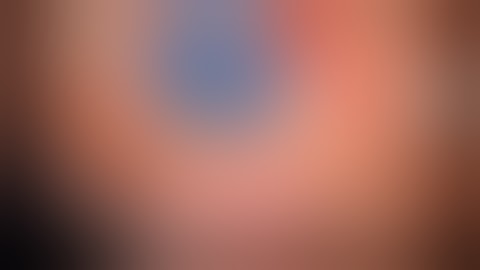 DMEK: unfolding techniques - NIIOS Rotterdam