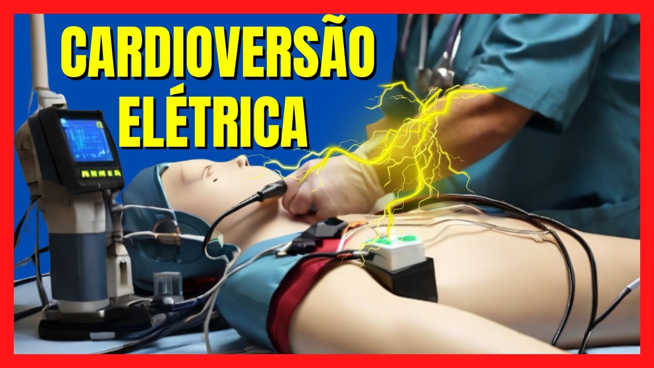 CARDIOVERSÃO ELÉTRICA COMO É ? PARA QUE SERVE ? PARA QUEM É INDICADO ...