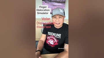 Volar Finger Dislocation | Reduction Technique practice | Athletic Training | Sports Medicine