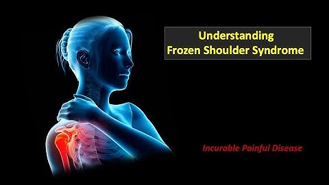 Frozen Shoulder Syndrome | New Medical Challenge | Dr S Bakhtiar Choudhary
