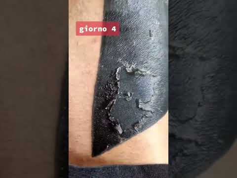 Video: Come pulire un nuovo tatuaggio (con immagini)