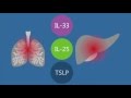 Immunology Advance: Blocking Alarmins to Treat Long-Term Disease