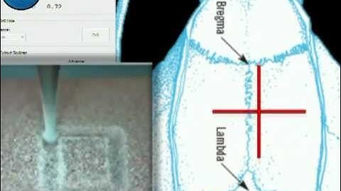 Neurostar - Drill Robot - Automated Stereotaxic Drilling