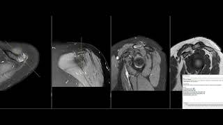 Radiologist at work - 10 MSK MRI in under 80min - LIVE reporting session [GERMAN]