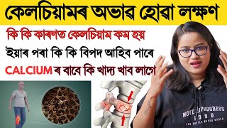 কেলচিয়াম ৰ অভাৱ হোৱা বাবে শৰীৰিত কি কি সমস্যা হব পাৰে || কি কি লক্ষণে দেখা দিয়ে ||  Ponkhi Sharma