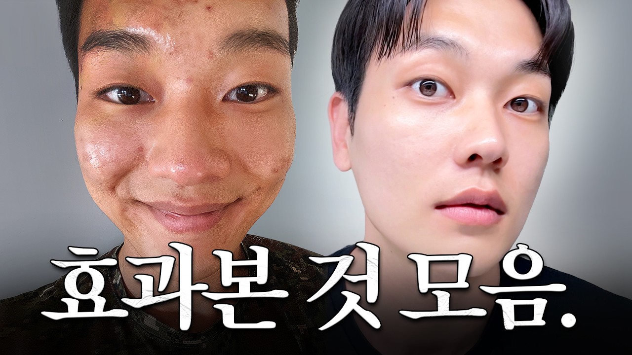 광고❌ 제발 써보세요..🙏🏻 진짜 효과본 올리브영 스킨케어 추천템 15가지🔥 (여드름/모공/수부지 내돈내산) | 화니HWAN'E