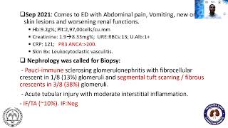 'Clinical Pearls ANCA Associated Vasculitis (AAV) 'Lecture #mac2021