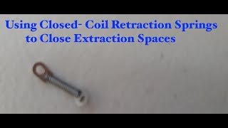 Power Chain Alternative- How to close  Spaces with Closed Coil Retraction / Protraction Springs