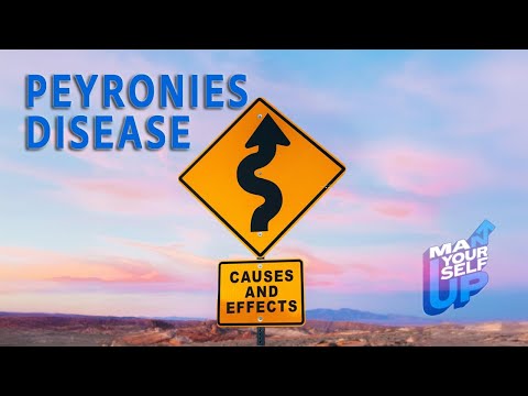 Causes and Treatments of Peyronies Disease