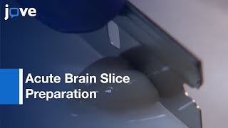 Acute Brain Slice Preparation Using Optimized Protective Recovery