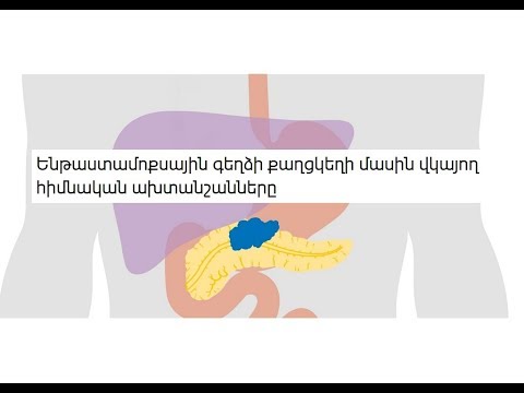 Video: Թքագեղձի քաղցկեղի դեպքում