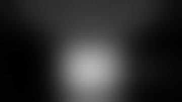 (OLD) Step 3: Robotic IOC (Cholangiogram on the Robot) - Robotic CBD Exploration Series