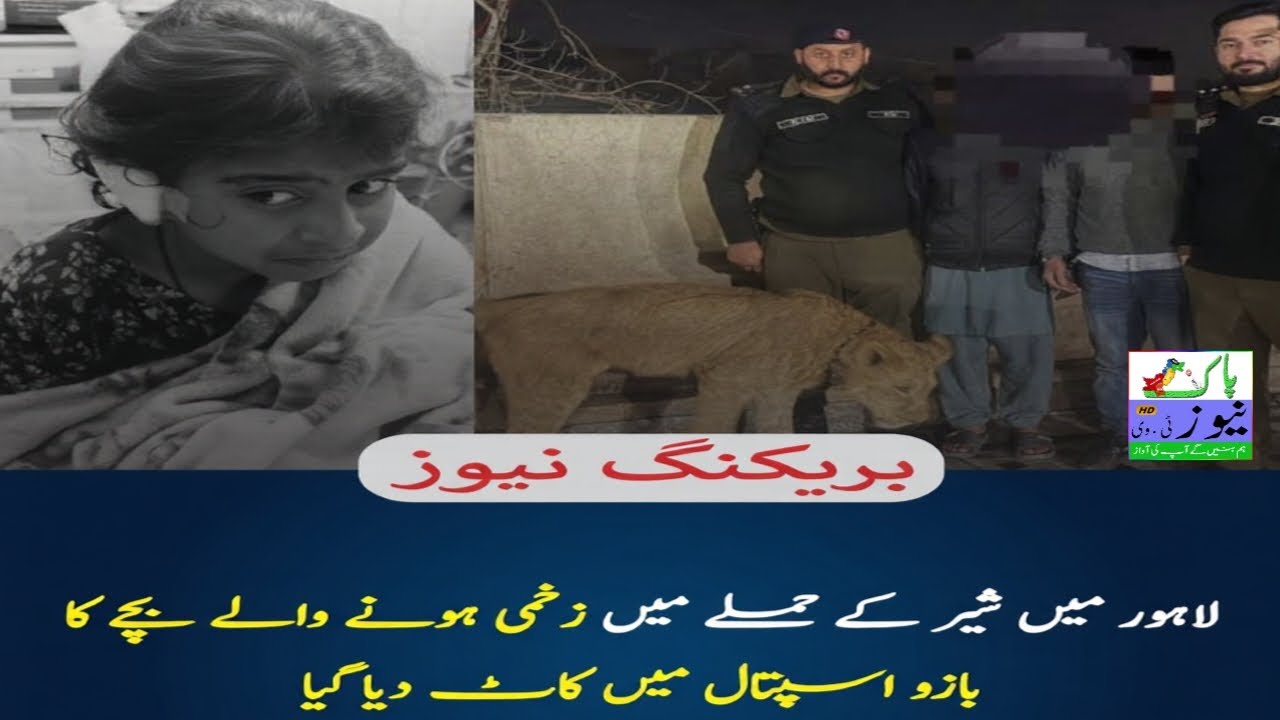 Lahore: Lahore mein sher ke hamlay mein zakhmi honay walay bachay ka bazoo doctors ne kaat diya.