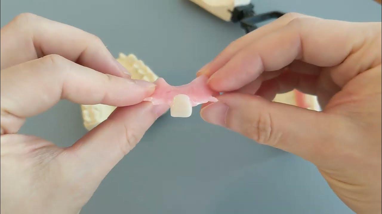 Front tooth flipper vs Back tooth flipper Appearance YouTube