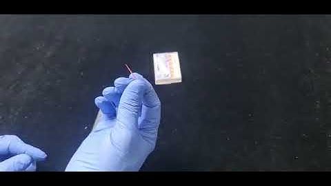 Dental Gutta Percha Points Measurement With Plastic Cutter. how to use