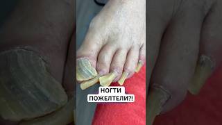 Заказать Микозоцид можно на Wildberries.Артикул - 450824076