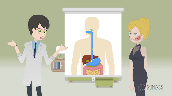 Accutane Tips and Product Recommendations