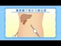 健康ぷらざ：胆石症（2015.3.15）