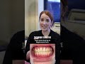 Veneers should support gum health-not compromise it 😲😣 #veneers #dentist 